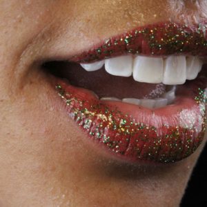 Ivaneide Júnia Gonçalves Santos, Sorrisos em cada detalhe, com lente de porcelana