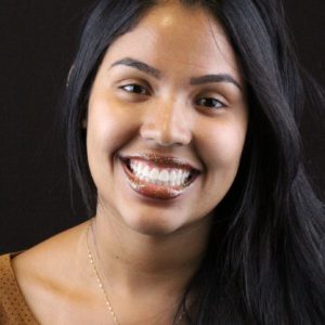 Ivaneide Júnia Gonçalves Santos, Sorrisos em cada detalhe, com lente de porcelana