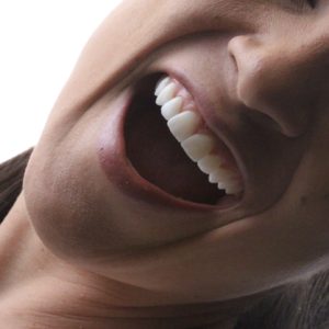 Lente de porcelana e DSD