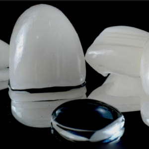 Lentes de contato dental, que é esse tratamento?