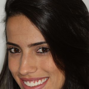 Lentes de contato dental, que é esse tratamento?