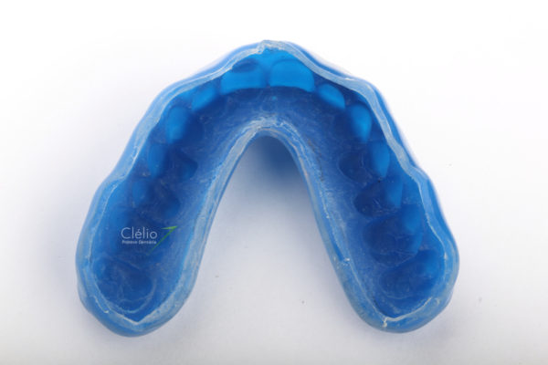 Você sabia que a saúde bucal interfere diretamente no rendimento da atividade física?