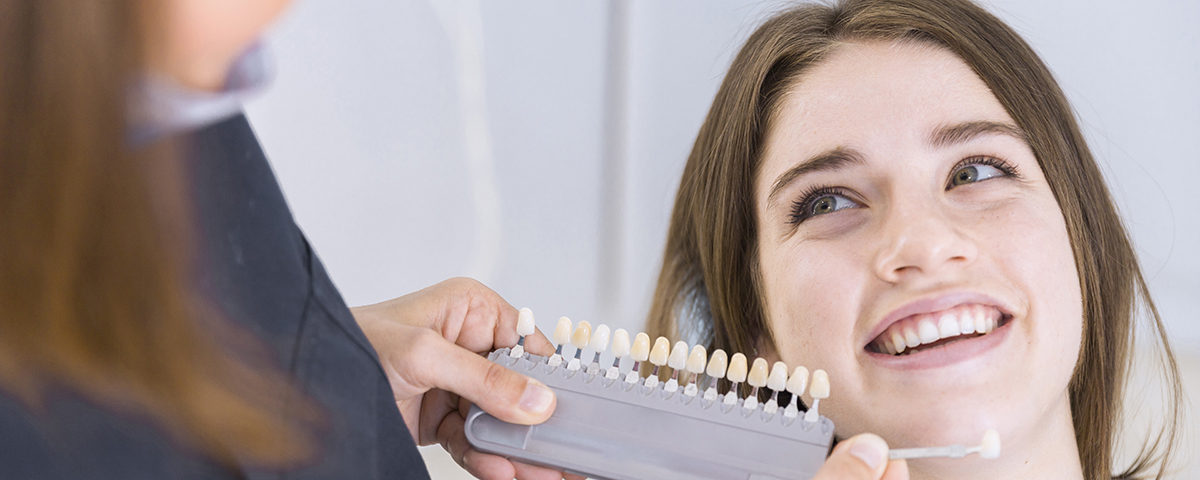 Facetas ou lentes de porcelanas