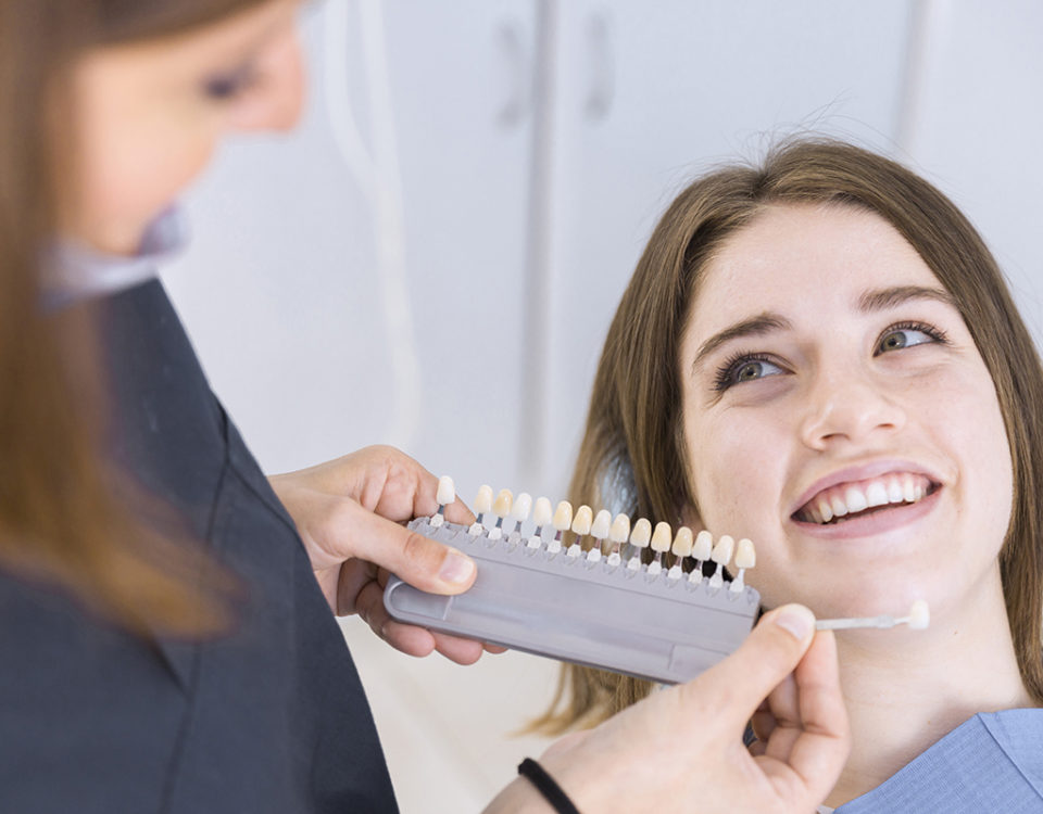 Facetas ou lentes de porcelanas